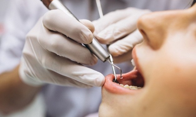 Нови надежи за корените на забите: Може да растат повторно со USAG-1 блокада