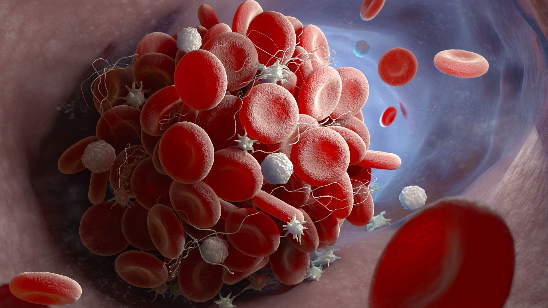 VITT i Генетско-Рефлексно имуни одговор: Вакцините и патолошкото згрутчување